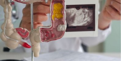 Colorectal Surgery Recovery-What Is Normal in the First 6 Weeks and What Should Worry You Colorectal Surgery Recovery-What Is Normal in the First 6 Weeks and What Should Worry You