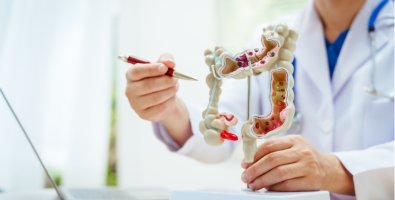 Early Detection of Colon Cancer Through Preventive GI Procedures Early Detection of Colon Cancer Through Preventive GI Procedures