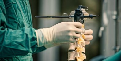 Endoscopic Spine Surgery vs Traditional Spine Surgery- Which One Is Safer Endoscopic Spine Surgery vs Traditional Spine Surgery- Which One Is Safer
