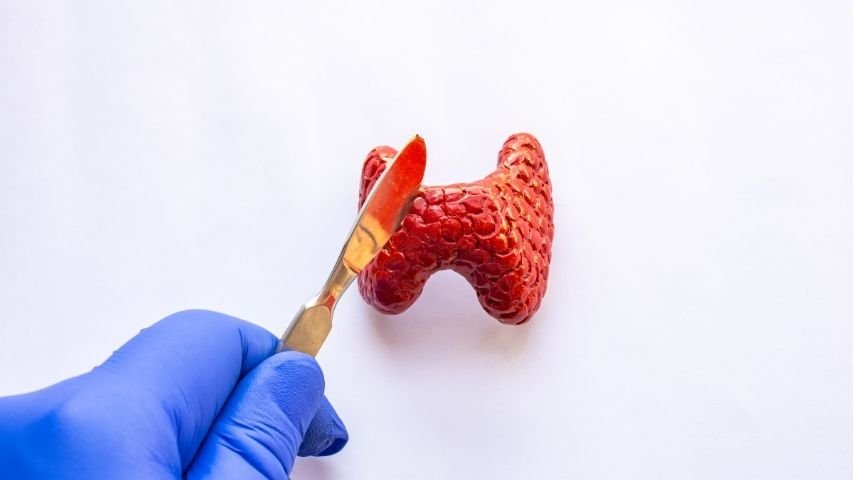 What Is Scarless Thyroidectomy- A Patient-Friendly Breakdown of How It Works What Is Scarless Thyroidectomy- A Patient-Friendly Breakdown of How It Works