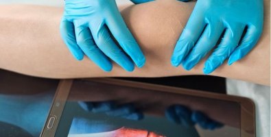 Is Genicular Artery Embolization Safe- Risks, Side Effects, and Success Rates Is Genicular Artery Embolization Safe- Risks, Side Effects, and Success Rates
