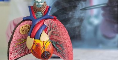 What to Expect Before, During, and After TBNA- A Step-by-Step Guide What to Expect Before, During, and After TBNA- A Step-by-Step Guide