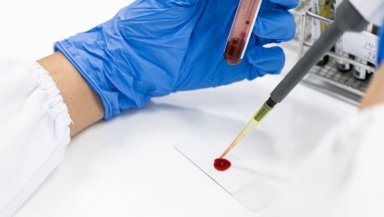 10 Powerful Blood Thinning Foods- Natural Ways to Reduce Blood Thickness Safely 10 Powerful Blood Thinning Foods- Natural Ways to Reduce Blood Thickness Safely