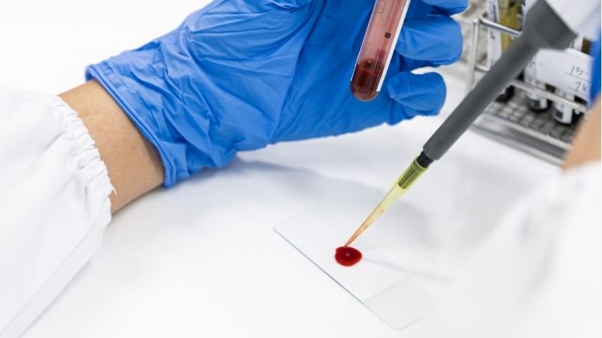 10 Powerful Blood Thinning Foods- Natural Ways to Reduce Blood Thickness Safely 10 Powerful Blood Thinning Foods- Natural Ways to Reduce Blood Thickness Safely