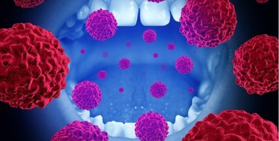 Seven Sites of Mouth Cancer Explained Simply- Where Oral Cancer Commonly Starts and Why It Matters Seven Sites of Mouth Cancer Explained Simply- Where Oral Cancer Commonly Starts and Why It Matters