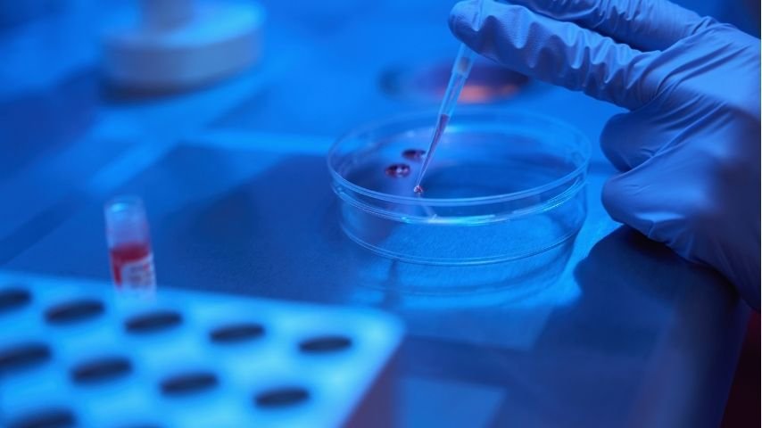 What Happens During an EBUS Cryobiopsy Step-by-Step Guide for Patients