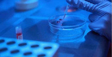 What Happens During an EBUS Cryobiopsy Step-by-Step Guide for Patients What Happens During an EBUS Cryobiopsy Step-by-Step Guide for Patients