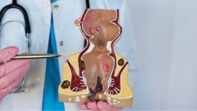 Grade 1, 2, 3 or 4 Piles- What Does Your Hemorrhoid Grade Actually Mean for Treatment Grade 1, 2, 3 or 4 Piles- What Does Your Hemorrhoid Grade Actually Mean for Treatment
