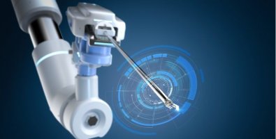 Robotic vs Open Nephrectomy- Real Patient Outcomes, Recovery, and What Truly Matters Robotic vs Open Nephrectomy- Real Patient Outcomes, Recovery, and What Truly Matters