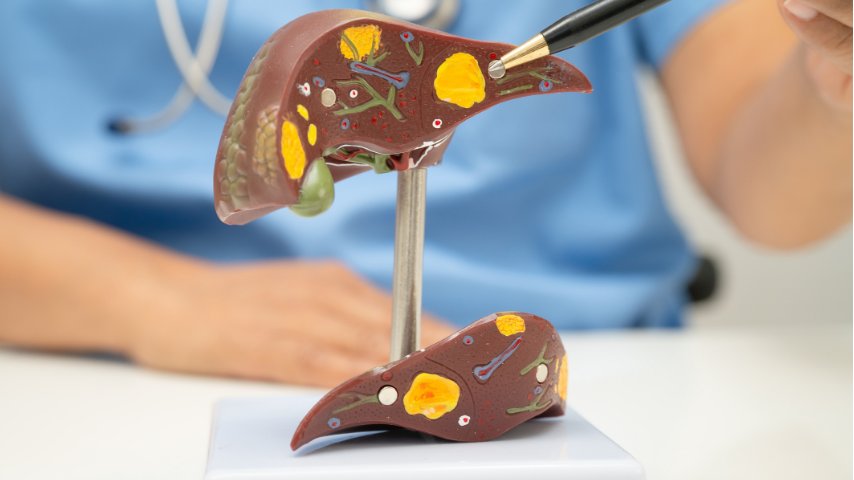 Signs of Fatty Liver- Causes, Symptoms, Treatment, and Best Ways to Improve Liver Health