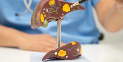 Signs of Fatty Liver- Causes, Symptoms, Treatment, and Best Ways to Improve Liver Health Signs of Fatty Liver- Causes, Symptoms, Treatment, and Best Ways to Improve Liver Health