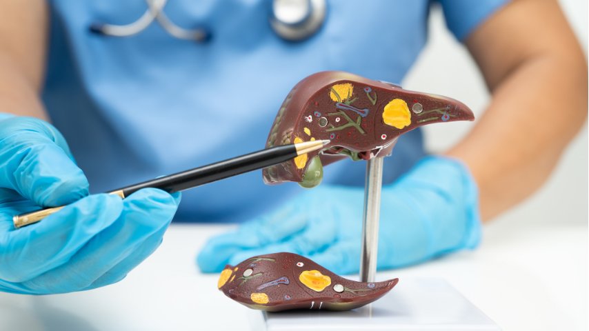 PSC Uncovered- Innovative Therapies, Symptom Control & Liver Transplant Pathways for Primary Sclerosing Cholangitis
