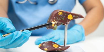 PSC Uncovered- Innovative Therapies, Symptom Control & Liver Transplant Pathways for Primary Sclerosing Cholangitis PSC Uncovered- Innovative Therapies, Symptom Control & Liver Transplant Pathways for Primary Sclerosing Cholangitis
