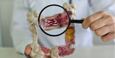 Colorectal Surgery Recovery Isn't Going as Expected- When Persistent Pain, Bowel Problems or Fatigue Need a Doctor's Review Colorectal Surgery Recovery Isn't Going as Expected- When Persistent Pain, Bowel Problems or Fatigue Need a Doctor's Review