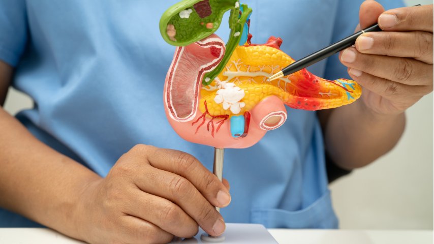 Distal Pancreatectomy and Splenectomy- How Losing the Spleen Changes Recovery and Long-Term Health Distal Pancreatectomy and Splenectomy- How Losing the Spleen Changes Recovery and Long-Term Health
