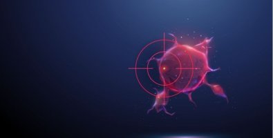 SBRT vs Surgery- Which Option Offers Better Outcomes for Early-Stage Cancer SBRT vs Surgery- Which Option Offers Better Outcomes for Early-Stage Cancer