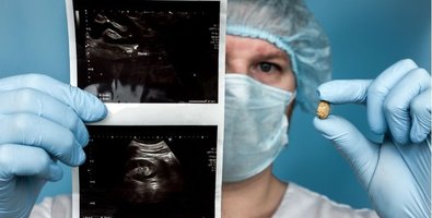 ECIRS Explained Simply-A Patient-Friendly Guide to Endoscopic Combined Intrarenal Surgery ECIRS Explained Simply-A Patient-Friendly Guide to Endoscopic Combined Intrarenal Surgery