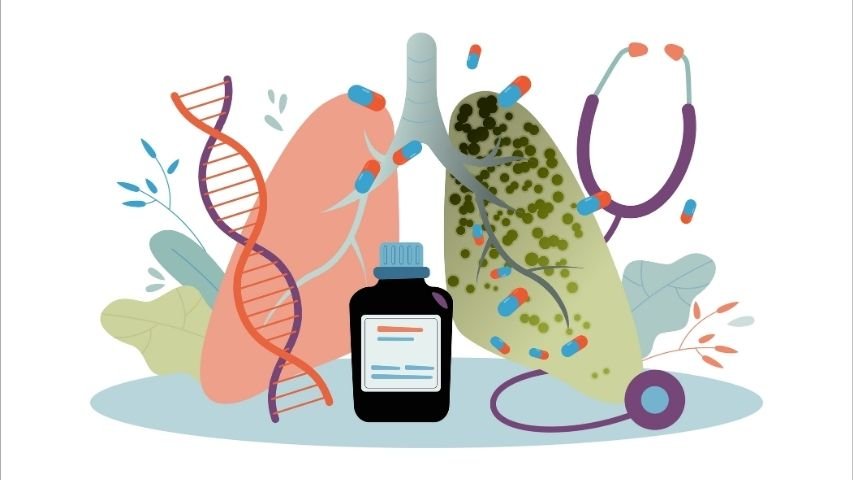 Cryobiopsy vs Forceps Biopsy