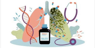 Cryobiopsy vs Forceps Biopsy Cryobiopsy vs Forceps Biopsy