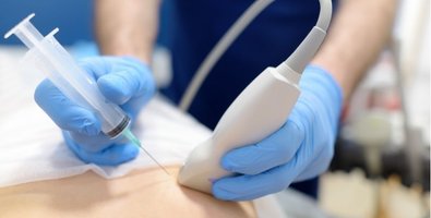 Robotic vs. VATS vs. Open Surgery for Mediastinal Lymph Node Dissection What’s the Difference Robotic vs. VATS vs. Open Surgery for Mediastinal Lymph Node Dissection What’s the Difference