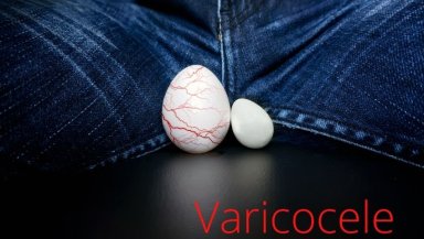 What Does Varicocele Embolization Feel Like-Real Patient Experience Explained What Does Varicocele Embolization Feel Like-Real Patient Experience Explained