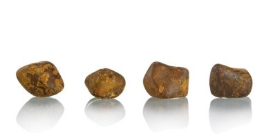 Gallstones 101- Causes, Symptoms, and How They Lead to Cholecystectomy Gallstones 101- Causes, Symptoms, and How They Lead to Cholecystectomy