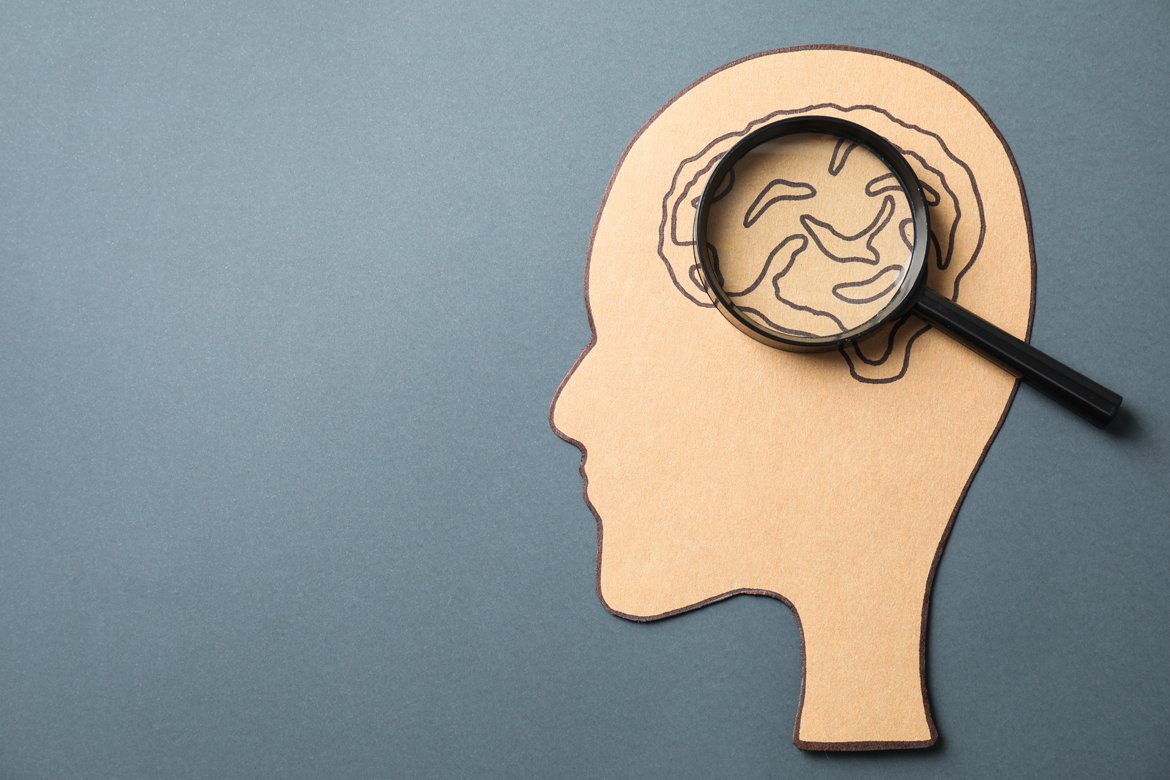 Diagnosed With a Brain Aneurysm? Here's What Happens Next