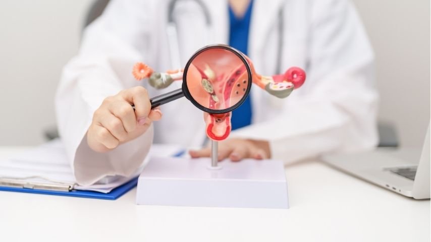 Why-Do-Fibroids-Come-Back-After-Treatment-Understanding-Recurrence-Risk