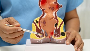 Why Do Piles Keep Coming Back? The Constipation, Straining and Toilet Habits That May Be Keeping Hemorrhoids Alive Why Do Piles Keep Coming Back? The Constipation, Straining and Toilet Habits That May Be Keeping Hemorrhoids Alive