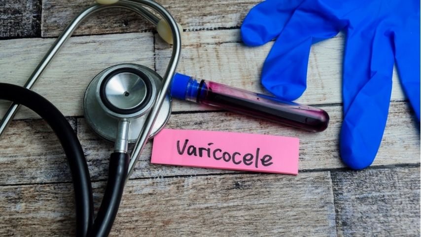 Why Does Testicular Pain Come and Go- Understanding Hidden Causes Like Varicocele