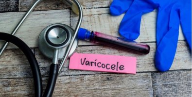 Why Does Testicular Pain Come and Go- Understanding Hidden Causes Like Varicocele Why Does Testicular Pain Come and Go- Understanding Hidden Causes Like Varicocele