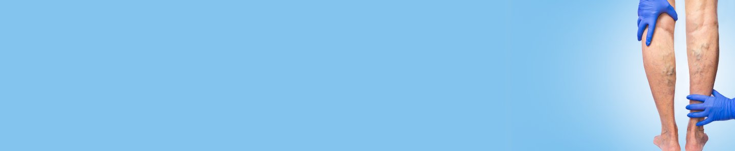 Vascular and Endovascular Surgery in India