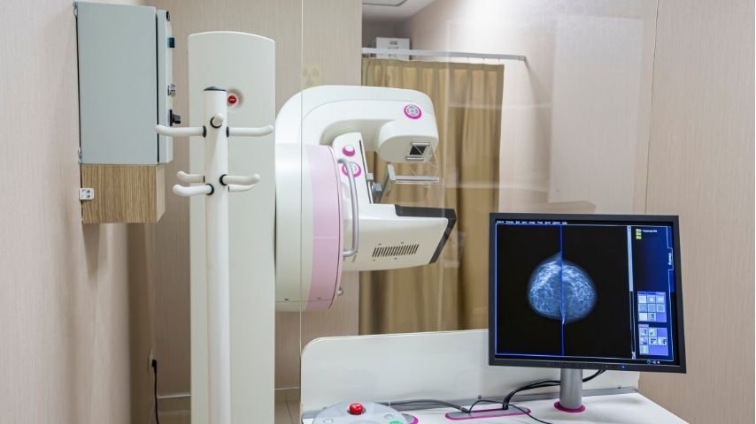 Practical Recovery Tips After Modified Radical Mastectomy- From Drains to Daily Life