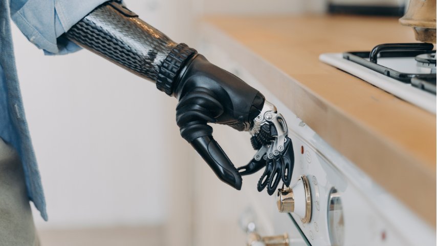 Hand Transplant vs Prosthetic Hand-Which Option Changes Life More