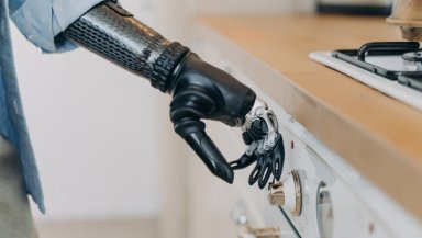 Hand Transplant vs Prosthetic Hand-Which Option Changes Life More Hand Transplant vs Prosthetic Hand-Which Option Changes Life More