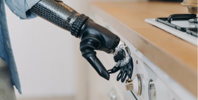 Hand Transplant vs Prosthetic Hand-Which Option Changes Life More Hand Transplant vs Prosthetic Hand-Which Option Changes Life More
