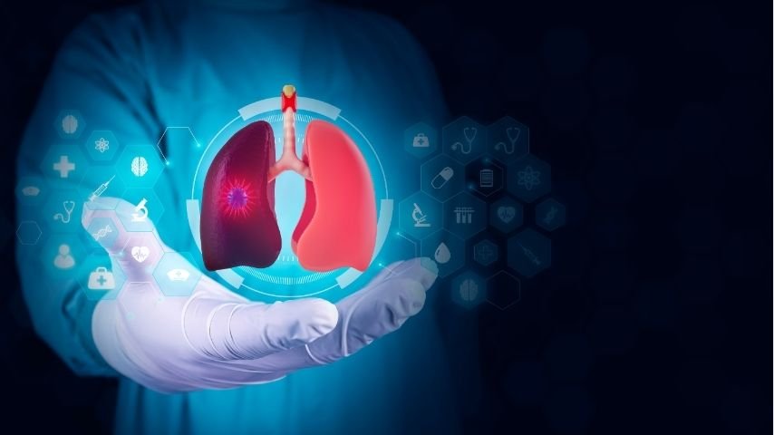 How Accurate Is CT-Guided Lung Biopsy for Diagnosing Lung Cancer How Accurate Is CT-Guided Lung Biopsy for Diagnosing Lung Cancer