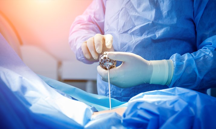 sciatica-article-microdiscectomy