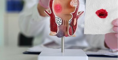 Rectal Bleeding, Pain or a Change in Bowel Habits- When Should You See a Colorectal Surgeon Rectal Bleeding, Pain or a Change in Bowel Habits- When Should You See a Colorectal Surgeon