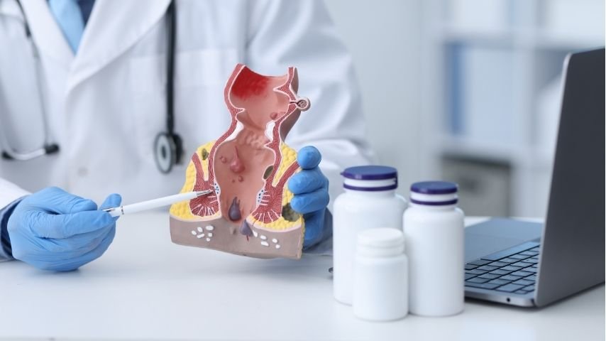 Why Does an Anal Fistula Take So Long to Heal- What Patients Should Know About Drainage and Recovery