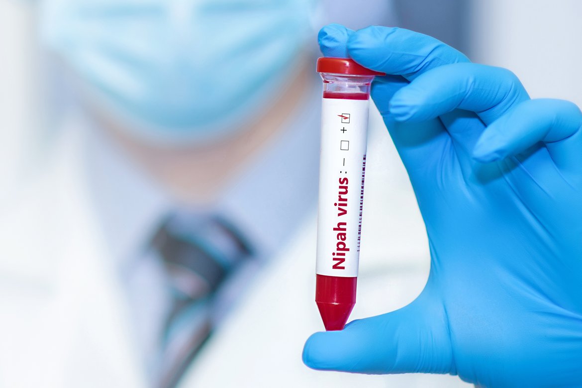 Nipah Virus: Symptoms, Spread, Risks, and What to Know 