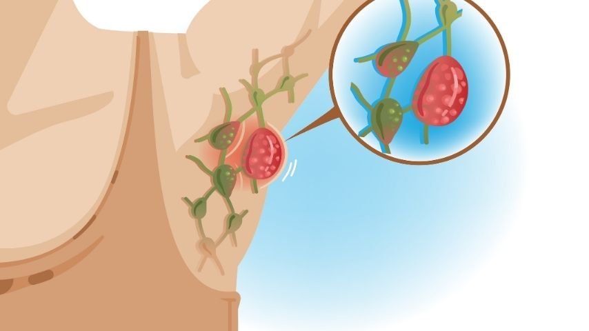 CT Scan Showing Enlarged Mediastinal Lymph Nodes- What It Could Mean