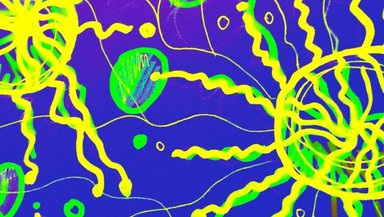 Allogeneic vs Autologous CAR-T Cells-Pros and Cons Explained Allogeneic vs Autologous CAR-T Cells-Pros and Cons Explained