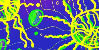 Allogeneic vs Autologous CAR-T Cells-Pros and Cons Explained Allogeneic vs Autologous CAR-T Cells-Pros and Cons Explained