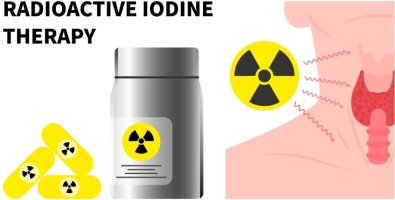 How Much I-131 Dose Do You Really Need- Understanding Low vs High Dose Decisions How Much I-131 Dose Do You Really Need- Understanding Low vs High Dose Decisions