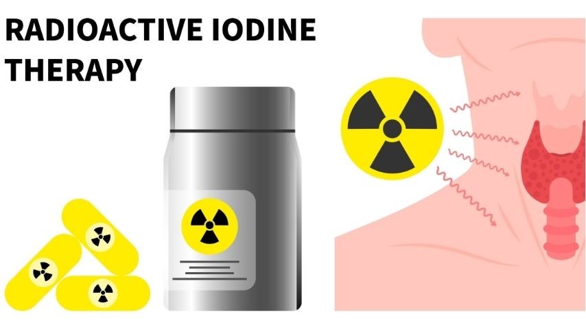 How Much I-131 Dose Do You Really Need- Understanding Low vs High Dose Decisions How Much I-131 Dose Do You Really Need- Understanding Low vs High Dose Decisions
