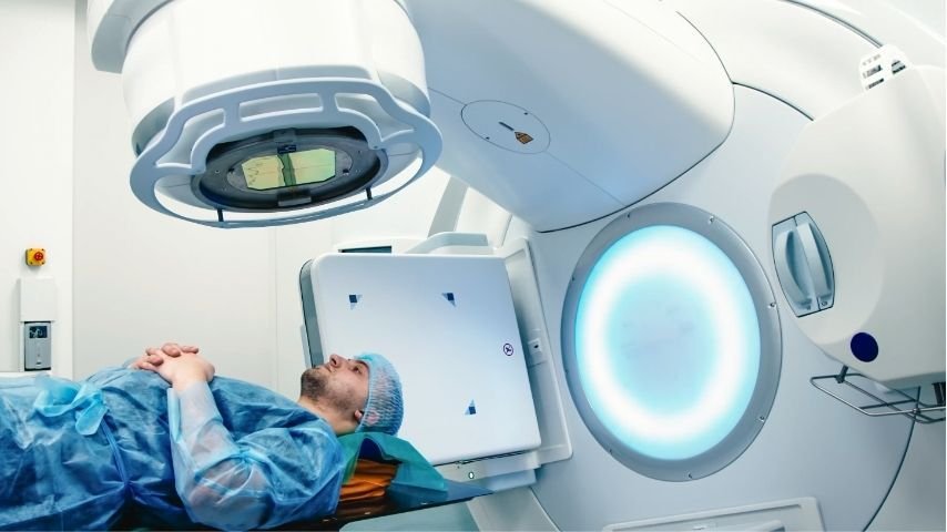 SBRT vs Traditional Radiation- What Patients Are Saying About Side Effects and Results