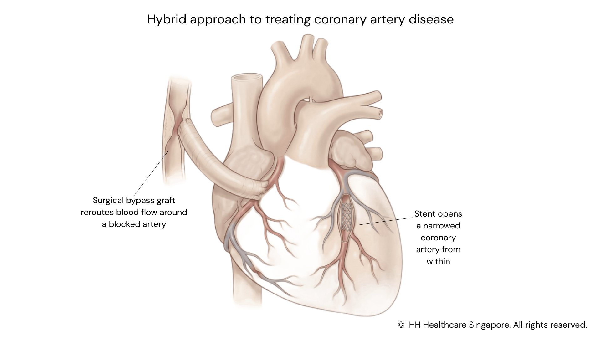 Hybrid approach to CAD 1920x1080