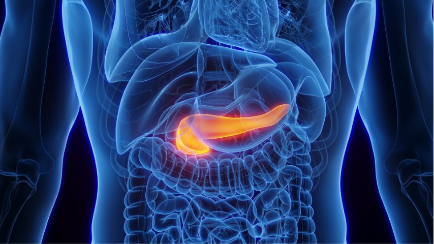 Is Distal Pancreatectomy Worth It- Real Patient Stories, Regrets, and Long-Term Outcomes