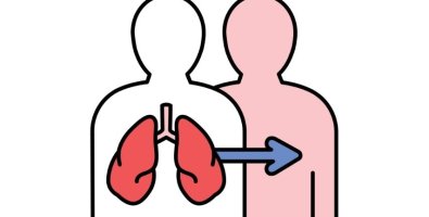 Am I Eligible for a Lung Transplant- Age Limits, Health Criteria and Tests Explained Am I Eligible for a Lung Transplant- Age Limits, Health Criteria and Tests Explained
